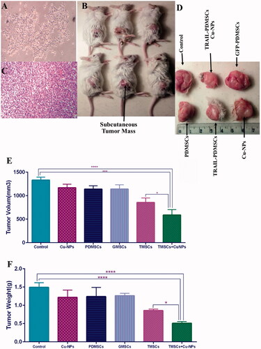 Figure 5. Anti-tumour effects of various treatment options in animal model of breast cancer. (A) 4T1 tumour cells were subcutaneously injected into right flank of BALB/c mice. (B) On the 28th day mice were sacrificed and tumour mass was removed. (C) H&E staining was performed on tumour tissues. (D) Tumour volume and weight were measured accurately as described in section “Materials and methods”. (E, F) TRAIL-PDMSCs when combined with Cu-NPs reduce tumour volume and weight to 0.44 and 0.34 as compared to control. All results are expressed by mean ± SD. *p < .05, ***p < .001, ****p < .0001. TMSC: TRAIL-PDMSCs; GMSC: GFP-PDMSCs.