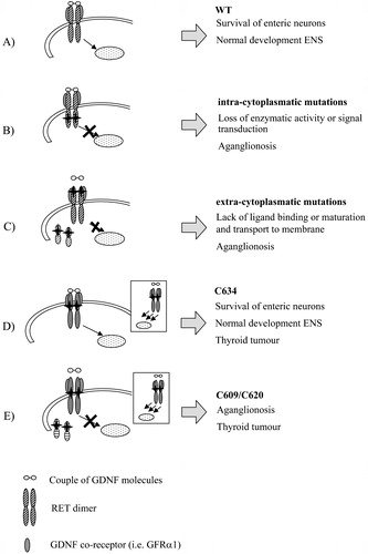 Figure 2. Pathogenetic mechanism of different RET mutations in enteric nervous system(ENS) development. The RET signalling complex is formed by a RET dimer, the ligand GDNF and co‐receptor GRFα1 (A). Intracytoplasmatic RET mutations (B) can lead to loss of activity of the RET protein, while in presence of extracellular mutations (C) either lack of binding activity or lack of exposure to the cell surface due to misfolding can occur. Mutations of cysteine residues of the cysteine‐rich domain confer a gain of function in thyroid tissues (represented in the boxes) leading to tumour. Depending on cysteine codons involved in the substitutions, either normal (D) or impaired (E) ENS development is achieved.