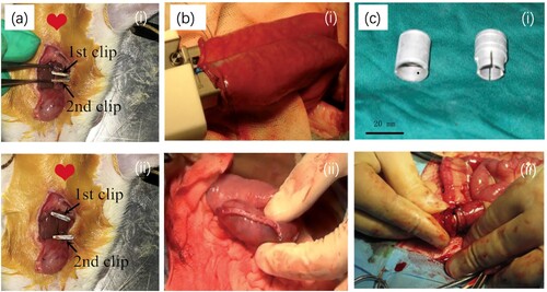 Figure 7. Animal studies of Mg-based surgical instruments for hemostasis and anastomosis. (a) Mg-Zn-Ca-Y alloy clip occluded the proximal and telecentric stump of rat carotid blood vessels (i), and cuts the blood vessel from the middle of the two hemostatic clips (ii) [Citation420]; (b) Pure-Mg staples for anastomose small intestine (i), and no bleeding and intestinal fluid exudation after anastomosis (ii) [Citation421]; (c) Mg–Zn–Sr intestinal anastomosis ring (i) and surgical procedure of intestinal anastomosis(ii) [Citation422].
