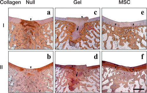 Figure 5. Histological findings after immunohistochemistry for type-I collagen (a, b, c) and type-II collagen (b, d, f) in the 3 groups 24 weeks after implantation. Scale bar: 2 mm. Immunopositive staining is brown, and immunonegative matrix is stained purple. Arrowhead in (a): intensely collagen type-I positive repair tissue covering the defect. Arrowhead in (b): collagen type-II-void reparative tissue covering the defect. Arrowhead in (c): very faint collagen type-I positivity in the repair tissue. Arrow in (c, d): excessive cartilage extruding through the deficient tidemark. Arrowhead in (d): partly positive collagen type-II immunoreactivity in the repair tissue. Arrowheads in (e, f): formation of distinct tidemark discriminating the articular cartilage and subchondral bone consisting of lamellar bone.