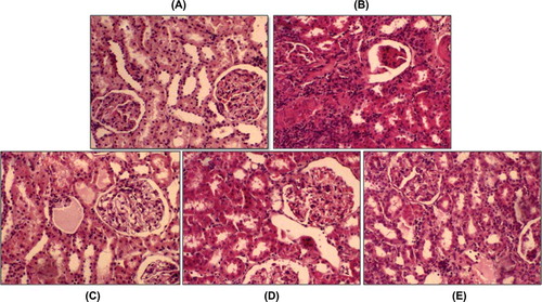 Figure 1 Representative histological photographs of kidney tissues from (A) sham group, (B) renal IRI, (C) renal IRI+NAC, (D) renal IRI+E, and (E) renal IRI+NAC+E. Sham rats show normal histological characteristic of glomeruli and tubules. Rats in the renal IRI group show marked necrosis with tubular dilation, swelling, luminal congestion, and medullar hemorrhage. Renal IRI+NAC and renal IRI+E groups show moderate kidney damage and moderate dilatation of the tubular structure. Kidney section in the renal IRI+NAC+E group shows minimal tubular dilatation and preservation of tissue histology of the kidney (hematoxyline–eosine).