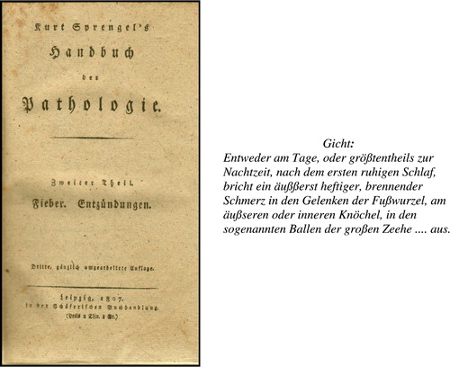 FIGURE 42 Daily pattern in the symptoms of gout described in Sprengel's Handbuch der Pathologie, second part, Schäfersche Buchhandlung, Leipzig (Sprengel, Citation1810, p. 125).