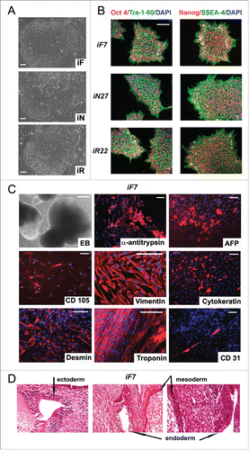 Figure 3. Characterization of isogenic iPSC lines reprogrammed from fibroblasts, neurons and RPE cells. (A) colony morphology of iF, iN, and iR cells; (B) immunocytochemical assay of iF, iN, and iR cells; for pluripotent markers (red and green indicate respective markers, blue indicates DAPI); (C) representative images of embryoid bodies and immunocytochemistry of in vitro iPSC-derived differentiated cell (red indicates markers, blue indicates DAPI) iF7 clones are shown. Scale bar, 100 mM; (D) Teratoma sections derived from the iF7 cell line, hematoxylin-eosin staining.