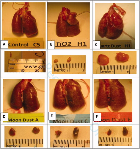 Figure 3. Lungs and lymph nodes (left tracheobronchial and parathymic lymph nodes). These tissues were isolated from rats of the high-dosed groups 13 wk after the dust instillation. Groups of 6 rats were each instilled with vehicle containing no dust (Controls, (A)), or 7.5 mg of TiO2 (B), quartz (C), LD-jm (Moon dust A), LD-ug (Moon Dust C) or LD-bm (Moon dust E). Lungs of TiO2-treated rats were unremarkable (B). The lungs of rats instilled with three LDs were similar (D–F), some superficial whitish nodules were visible. Nodules in the lungs of quartz-treated rats were larger; the lungs were lumpy and rough (C). The lymph nodes (LNs) of quartz-treated rats were much bigger and firm, the left tracheobronchial LN is visible as a translucent lump of the size a peanut front of the trachea and at the center above the lung in (C). LNs isolated from LD-exposed rats were smaller (grayish LD particles inside the LNs made the LNs appeared darker) (D–F); LNs of control animals were too small and could not be found, except from one animal (A).