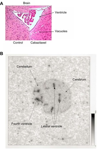 Figure 5 Mouse brain histopathology and autoradiography.