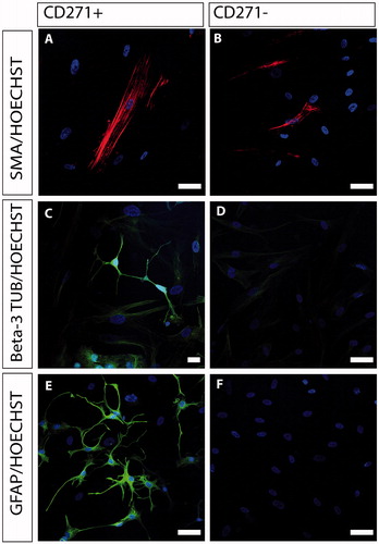 Figure 3. Immunocytochemical characterization of CD271+ (A, C, E) and CD271- (B, D, F) bone marrow stromal cells. CD271- cells were able to differentiate into smooth muscle cells, showing positive expression of SMA (B, red), but showed little or no expression of beta-3 tubulin and GFAP, and were thus unable to differentiate into neurons and glia cells, respectively. The CD271+ cells expressed SMA (A, red), beta-3 tubulin (C, green), and GFAP (E, green). Nuclei were counterstained with Hoechst (blue). Scale bar in A, B, D, E, and F, 50 µm. Scale bar in C, 20 µm.
