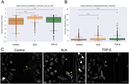 Figure 6. Vimentin expression in PC-3 cells at the migratory front in the presence of SLN after 12 hours of migration. PC-3 cells were deprived of FBS for 24 h, then were treated with SLN:pET28A or TGF-β (10 ng/mL) for 4 h. After treatment, the culture medium was replaced with RPMI without SFB and vertically scratched using a p200 pipette tip. The cells were fixed after 12 h of migration and immunostained for vimentin. Images were acquired on Cytation 5 cell Imaging Multi-Mode Reader (BioTek Instruments, Inc., Winooski, VT, USA) using 20× objective. Quantification of the intensity and texture in single-cells was made using CellProfiler. Cells with mesenchymal-like phenotypes are indicated with a yellow arrow. Scale bar represents 50 μm. (A) Cells_texture_InfoMeas1_vimentin_20_03_256 feature,(B) Cells_intensity_IntegratedIntensity_vimentin, and (C) Representative images of PC-3 cells. Cells with mesenchymal-like phenotypes are pointed by yellow arrows. Scale bar 50 µm. All points represent the single-cells of two independent experiments (n = 1). Z-test (comparison of means with all other means) was performed using statannotations and statmodels package: ****for p< =1.00e-04.