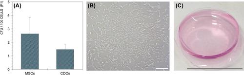 Figure 2. CDCs in monolayer (A) and hydrogel (B) culture, and quantification of MSC and CDC CFUs (C). Scale bars are equivalent to 200 μm (A) and 22 mm (B).