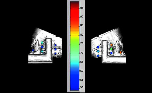 Figure 5. Graphical representation of the Fiducial Registration Errors (FREs). Shown are 3D reconstructions of the skull and fiducial frame from the CT scans. The fiducials are colored according to error (blue=least error, red=most error; a numerical scale corresponding to colors is shown at right). The left panel presents the left side (fiducials #8–14), while the right panel presents the right side (fiducials #1–7) (see Figure 2 for fiducial numbering scheme).