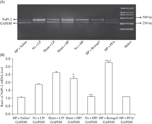 Figure 3. NaPi-2 mRNA expression in different rat groups. (A) Expression of NaPi-2 mRNA by RT-PCR. PCR products were separated in 1% agarose gel and stained with ethidium bromide. (B) Densitometric data of renal NaPi-2 mRNA abundance. NaPi-2 mRNA signals were quantified by image analysis software BandScan 4.3. Data were expressed versus GAPDH and compared with ANOVA.Notes: All results were from three independent experiments, and analysis was done by a core service center in a double-blinded manner. *Significantly different from Sham + LP group at p < 0.05, **significantly different from Nx + LP group at p < 0.01, and ***significantly different from Nx + HP group at p < 0.01.