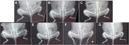 Figure 7 Radiographic analysis of rat hind paw from different groups. (A) Normal control group and (B) DH - TENV gel group showed normal tissue with no signs of inflammation, bone enlargement or bone damage. (C) Complete Freund’s adjuvant (CFA) arthritic group showed observable excess soft tissue volume, joint space, sub-chondral erosion, periostitis, osteolysis, subluxation, degenerative joint changes with signs of inflammation at the metatarsal-phalangeal joint and the regions in-between the bones of the phalanges and the metatarsals. (D) Rheumatoid arthritis group treated with methotrexate showed almost normal soft tissue with disappearance of inflammatory signs and no bone enlargement was observed. (E) Rats treated with DH - gel, (F) DH - TENV gel and (G) Oral DH exhibited significant and comparable inhibition of soft tissues swelling that surrounded the bones of the foot and bone enlargement.