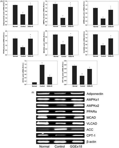Figure 3. The mRNA expression levels of genes involved in fatty acid oxidation in visceral adipose tissue of obese mice. (A) Adult male C57BL/6J mice were fed a low-fat diet (normal), a high-fat diet (control), or the high-fat diet supplemented with 250 mg/kg/d GGEx18 for 8 weeks. Total cellular RNA was extracted from visceral adipose tissue and mRNA levels were measured using RT-PCR. All values are expressed as the mean ± SD of relative density units using β-actin as a reference. #p < 0.05 compared with the normal group, *p < 0.05 compared with the obese control group. (B) Representative RT-PCR bands from one of the three independent experiments are shown.