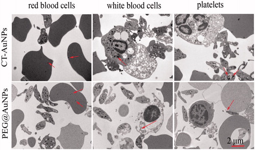 Figure 4. The TEM images of blood components: RBC, WBC, PLT, pretreated with CT-AuNPs and PEG@AuNPs (arrows indicate CT-AuNPs or PEG@AuNPs).