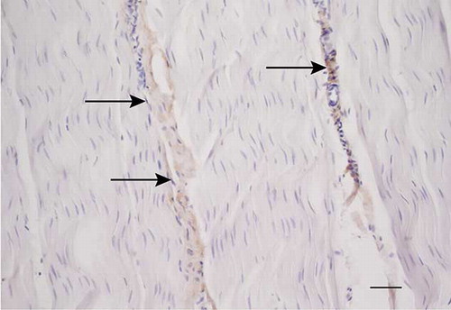 Figure 8. Microscopic longitudinal section of a normal tendon from a control (K). Immunohistochemical localization of type III collagen. A marked immunostaining is present in the endotenon (arrows), but the aligned fibers do not show any staining. K refers to tendon ID (see Tables 1 and 2). Bar = 100 μm.
