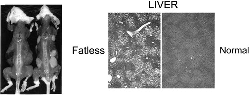 Figure 2 An example of a lipoatrophic mouse model Citation11. These mice (mouse on the left in the panel on the left) are unable to store fat subcutaneously but store excessive amounts of fat in the liver. The liver becomes severely insulin resistant. Transplantation of normal adipose tissue subcutaneously (mouse on the right in the panel on the left) removes excess fat and normalizes insulin sensitivity in the liver. Reproduced with permission from Citation11.