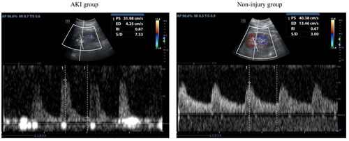 Figure 1. The representative ultrasound images of patients.