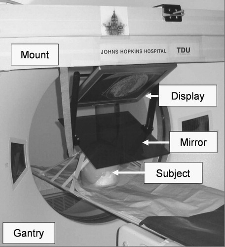Figure 4. Image overlay system that creates the floating image in the scan plane of the CT gantry. (A close up of this experiment is shown in Figure 2.)