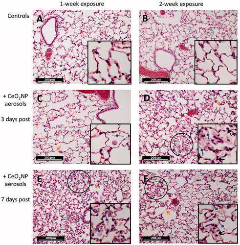 Figure 4. Representative hematoxylin and eosin stained lung sections (×200, inset ×400) from rats of negative controls (A and B) and CeO2NP aerosol exposure at 3 d (C and D) and 7 d (E and F) post-exposure (A, C, E, 1-week exposure; B, D, F, 2-week exposure). Symbols indicate some histopathological observations including infiltration of inflammatory cells (black arrows), deposition of amorphous eosinophilic materials (diamond arrows), alveolar wall injury (open arrows) and minor alveolar epithelial hyperplasia (areas inside black circles).