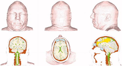 Figure 1. Finite volume version of Head-Neck model. Top: front, rear, and left side views. Bottom: coronal, axial, and mid-sagittal cuts showing internal structure.