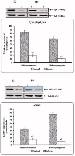 Figure 13. Immunoblot to estimate synaptophysin and nNOS proteins. Levels of these proteins were found to be significantly reduced in long-term diabetic animals when compared to control.