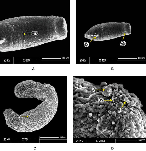 Figure 4 Scanning electron micrography of S. mansoni schistosomula. Ultrastructure of Sschsiistosomula incubated in medium with 1% DMSO (control group) exhibited (A) intact integument with relatively flat surface and slight tegumentary ridges (STR; bar 100 µm) and (B) an apical constriction (AC) between the head and the body region. At the posterior end of the body, there was a prominent tail-socket (TS) wound left by the breakage of the tail (bar 300 µm). After 72 hours of exposure to PSO, Sschsiistosomula showed (C) swelling of body with obvious wrinkling (W) and focal lesions (FL). There was an elongation of the worm, which may indicate flaccid paralysis (bar 200 µm). (D) Blisters (BL), blebs (B), and vesicles scattered on the surface (bar 50 µm) at high concentration (100 µL/mL) of PSO.