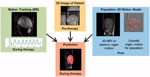 Figure 3. Overview of the main components for motion modelling based on a generic motion model, a pre-therapy breath-hold 3D image and partial observations from motion tracking during therapy.