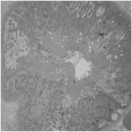 Figure 2. Electron microscopy showed cells with well-defined brush border and basolateral membranes. ×2000.
