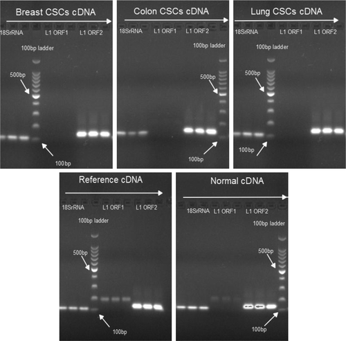Figure 1. Determining expression of L1 ORF1 and L1 ORF2. The presence of L1 ORF1 and L1 ORF2 mRNA was determined in CSCs, cancer cell lines, and non-cancerous (normal) samples. Expression of 18SrRNA was used as control. All reactions were performed in triplicates. The estimated length of PCR products is L1-ORF1: 187bp, L1-ORF2: 137bp, and 18srRNA: 112bp.