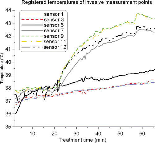Figure 6. Registered temperatures of the invasive measurement points during treatment 3 (see Figure 1 for the position of the probe). Sensor 1 represents the tip of the thermocouple probe. For clarity, only a selection of the 14 invasive measurement points was plotted.