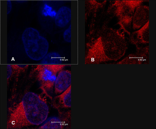 Figure 4 Confocal laser scanning micrographs of the interaction between ultradeformable vesicles labeled with rhodamine and Colo-38 cells using: (A) Hoechst filter and (B) TRITC filter; and (C) superimposition of figures. Reprinted with permission from Cosco D, Paolino D, Maiuolo J, et al. Ultradeformable liposomes as multidrug carrier of resveratrol and 5-fluorouracil for their topical delivery. Int J Pharm. 2015;489(1–2):1–10. Copyright © 2015 with permission from Elsevier Ltd.Citation56