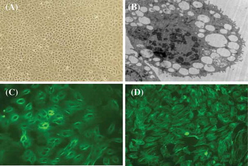 FIGURE 1. Representative microscopy images of rat peritoneal mesothelial cells (RPMCs). (A) Typical cobblestone pattern in RPMCs at ×200 magnification; (B) typical microvilli on RPMC at ×4200 magnification; (C) immunofluorescent stain for keratin at ×400; and (D) immunofluorescent stain for vimentin at ×400. The representative pictures are shown here.
