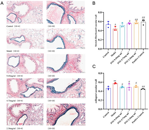 Figure 5. PNS’s effect on pulmonary vascular remodeling induced by COPD in rats.Note: (A) Victoria + VG staining results of lung tissues from rats in each group (10 × 10). (B) Proportion of elastic fibers in lung tissues from rats in each group. (C) Proportion of collagen fibers in lung tissues from rats in each group. Compared to Control, **p <0.01, *p <0.05; compared to Model, ##p <0.01, #p <0.05.