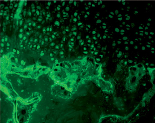 Figure 5. Fluorescent microscopic appearance of the border between regenerated tissue and the subchondral bone at 8 weeks after surgery. GFP-positive cells were not detected in the subchondral bone area below the regenerated tissue.