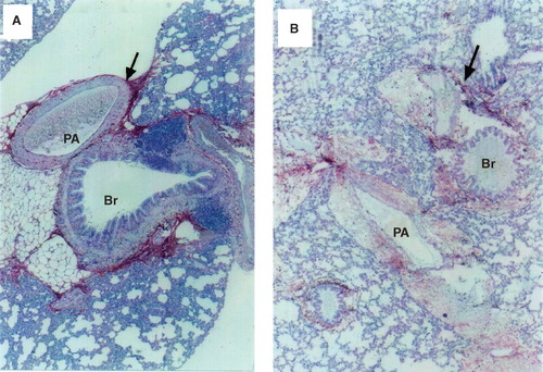 Figure 2. A: Staining of lung sections with biotin-avidin-hyaluronan-binding protein in a control rat. The red area represents hyaluronan-specific staining. The arrow indicates the intense staining of the perivascular and peribronchiolar space. The section was counterstained with hematoxylin (×140). B: Staining of lung sections with biotin-avidin-hyaluronan-binding protein in a representative rat with thrombin-induced pulmonary injury. The red area represents hyaluronan-specific staining. The arrow indicates the weaker staining of hyaluronan in the perivascular and peribronchiolar space. The section was counterstained with hematoxylin (×140). (PA = pulmonary artery; Br = bronchus.)
