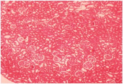 Figure 1. Kidney of control rat treated with saline for 7 days showing normal renal cortex and glomeruli (HE × 100).