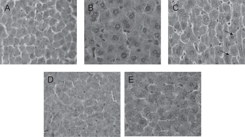 Figure 1.  Liver tissue portions (100 ×) of control (A) and experimental (B, C, D and E) dams. Observe the mild congestion in the hepatocytes of the 7,000 mg/kg aqueous extract dose treated dams (C arrows). (B) and (C) 1,400 and 7,000 mg/kg/day aqueous extract, respectively. (D) and (E) 1,400 and 7,000 mg/kg/day ethanol extract, respectively.