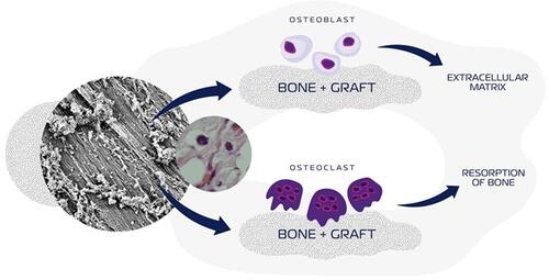 Figure 1 Schematic illustration of a synthetic-HA and/or ß-TCP-based biomaterials influences bone deposition, osteoblast activities, bone resorption, and osteoclast activities.