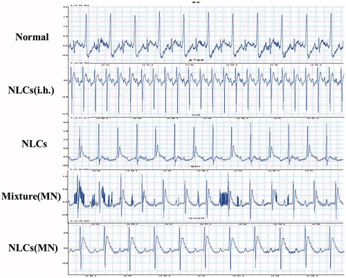 Figure 8. Representative ECG results for rats after percutaneous and hypodermic applications.