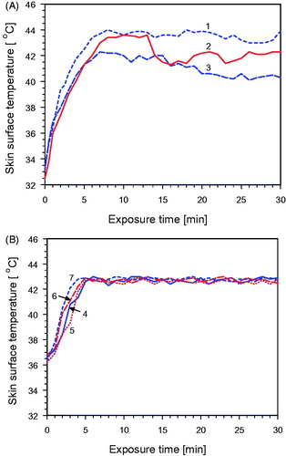 Figure 10. Skin surface temperature as a function of exposure time using a wIRA irradiance of 200 mW cm−2. (A) Temporally constant exposure of the backs of three healthy volunteers (1–3) without temperature control. (B) Controlled skin exposure by switching on/off according to the thermographic feedback signal (see Figure 2). In different treatments measurements were taken on normal skin (4), on lymphangitis carcinomatosa (5), on tumor tissue (6) and on tumor/scar tissue (7). Initial skin surface temperature of patients was slightly elevated due to activities in preparation of the treatment. No air ventilation, room temperature 22–24 °C.