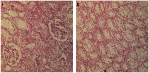 Figure 5. Photomicrographs of group Tin (T. indica extract treated): (A) renal cortex presenting normal glomeruli and tubules. No common abnormality was identified and (B) renal medulla also presenting normal tubules with no hydropic changes or ruptured tubules.