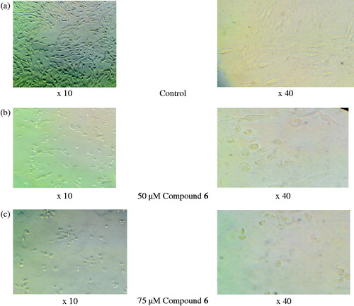Figure 4. Images of LNCaP cells under microscope treated with compound 6.