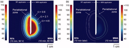 Figure 2. Temperature distributions computed from RFA(Cool-tip applicator, pulsed protocol, 10 min) and MWA (Amica-Gen applicator, 60 W continuous application, 10 min) just after switch-off (a) and 10 min later (b). White lines represent limits of coagulation zone (Ω > 4.6) and periablational zones (0.6 < Ω < 2.1). (Scale in °C; MWA temperatures exceeded 110 °C).