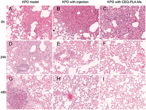 Figure 6. H and E staining of lung tissues from rats after experimental treatments KPD model (infected, no drug) (A, D, and G); KPD model treated with CEQ only injection (B, E and H); KPD model treated with CEQ-PLA-microspheres (C, F and I). Haematoxylin–eosin. Magnification 20×.