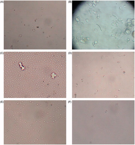 Figure 2. Light microscopic images of calcium oxalate crystals in urine. (A) Control, (B) nephrolithic, (C) prophylactic treatment with cystone (150 mg/kg), (D) prophylactic treatment with cystone (300 mg/kg), (E) prophylactic treatment with extract of B. ciliata (150 mg/kg), and (F) prophylactic treatment with extract of B. ciliata (300 mg/kg).