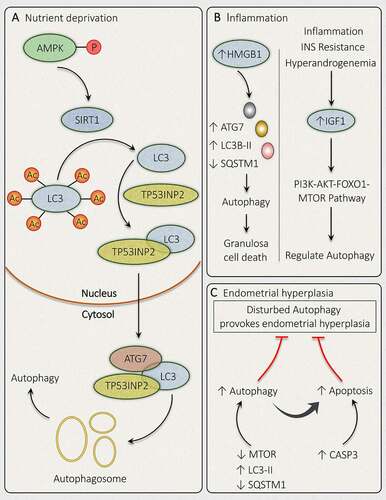 Figure 9. Mechanisms governing autophagy during different conditions related to PCOS. In PCOS, autophagy is depicted in response to different conditions such as (A) Nutrient deprivation: In ovaries, phosphorylation of AMPK induces deacetylation of LC3 via SIRT1 activation. Activated LC3 binds with TP53INP2, which promotes its translocation from the nucleus to the cytoplasm, where it can bind with ATG7 and initiates autophagosome formation. (B) Inflammation: Autophagy activation is accompanied by inflammation in PCOS via an increase in HMGB1, which stimulates autophagy in granulosa cells and causes its death. Whereas, an enhanced level of IGF1 is involved in governing autophagy via the PI3K-AKT-FOXO1-MTOR pathway. (C) Endometrial hyperplasia: Defaulted autophagy triggers hyperplasia in the endometrium in PCOS, which is reduced by induction of autophagy and autophagy induced apoptosis