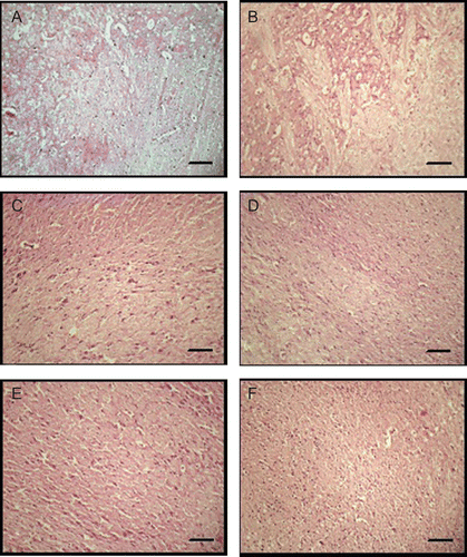 Figure 1.  Neuroprotective effect of German chamomile methanol extract against AlF4−-induced oxidative brain damage in rats. Photographs of brain sections from different treatment groups stained with hematoxylin and eosin (H&E), 10×. Plates: A: normal; B: AlF4−-treated group; C–E: 100 mg/kg + AlF4−; 200 mg/kg + AlF4− and 300 mg/kg + AlF4−, respectively; and F: quercetin 25 mg/kg + AlF4−. In plate B, AlF4− through the drinking water caused brain damage in rats. There was a marked increase in intracellular space, neutrophil infiltration, and neuronal necrosis observed in the hippocampus region in AlF4−-treated animals (B). There was a significant reversal of damage observed in German chamomile-treated groups (C–E) and also in quercetin-treated group (F). Scale bar: 100 µm.
