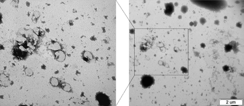Figure 2. TEM images of archaeosomes were unilamellar spheres of diameters close to 100 nm.