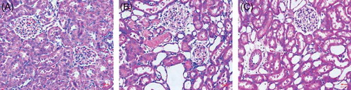Figure 1. Histologic changes in the kidney at the end of 48 h of reperfusion. Tissues were stained with hematoxylin and eosin. Shown are representative histological specimens from the control group (A); renal I/R + NS group (B); and I/R + NGAL group (C). Magnification ×100.