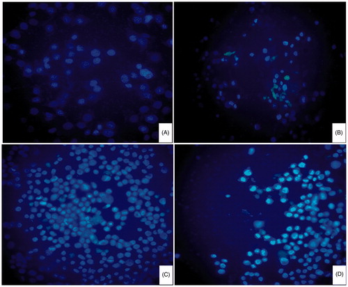 Figure 5. Observation of HeLa cells in different groups by fluorescence microscope. (A) control group; (B) free DOX group; (C) DOX/P(HB-HO) NPs group and (D) DOX/FA-PEG-P(HB-HO) NPs group.