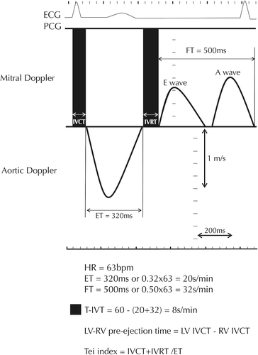 Figure 1. Schematic presentation of LV filling and ejection spectral Doppler showing how global markers of dyssynchrony, that is, total isovolumic time (t-IVT), Tei index and LV–RV pre-ejection times, are measured. LV: left ventricle; RV: right ventricle; HR: heart rate; ET: ejection time; FT: filling time; IVCT: isovolumic contraction time; IVRT: isovolumic relaxation time.
